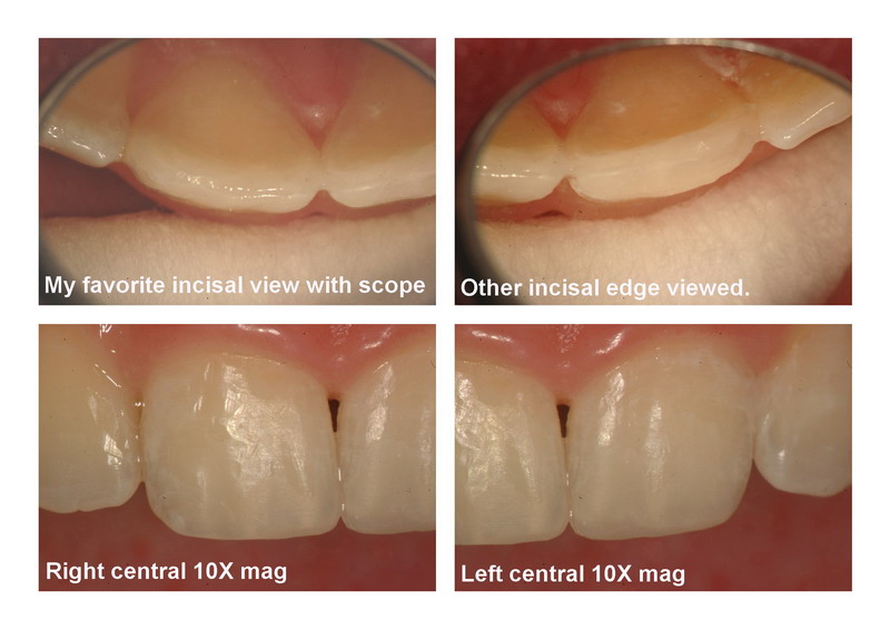 Bevel pg 3 edited_resize.jpg